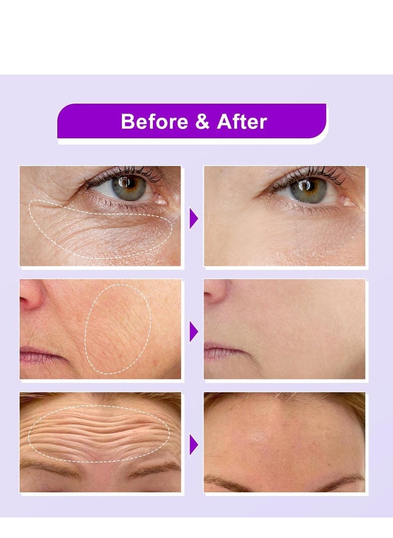 JoyPretty - 3% Bakuchiol Serum, With Triple Retinol Complex and 3% Niacinamide, Bakuchiol Oil Face Serum for Women to Reduce Fine Lines and Wrinkles, 40ml Anti-Aging Formula for Smoother, Brighter Skin - Image 1
