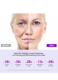 JoyPretty 3% Bakuchiol Serum, With Triple Retinol Complex and 3% Niacinamide, Bakuchiol Oil Face Serum for Women to Reduce Fine Lines and Wrinkles, 40ml Anti-Aging Formula for Smoother, Brighter Skin  - Image 5