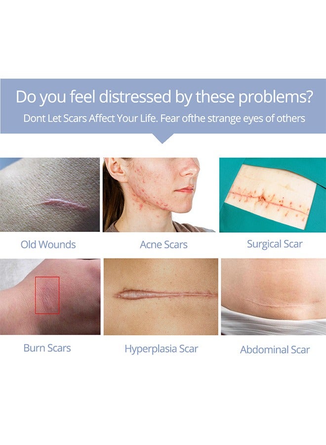 MSLAM Scar Repaie Gel, scar Removal Gel Suitable For New And Old Scars On Cuts, Stretch Marks,Face And Body Burn Recovery Gel (20g) - Image 5