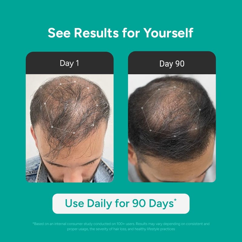 Arata Intensive Hair Growth Serum for Men  Women  3 Redensyl 3 Procapil  5 Kopexil  Onion Turmeric  Rice Water  Controls Hair Fall Boosts Hair Growth  Strengthens Hair  Pack of 3 90ml - Image 2