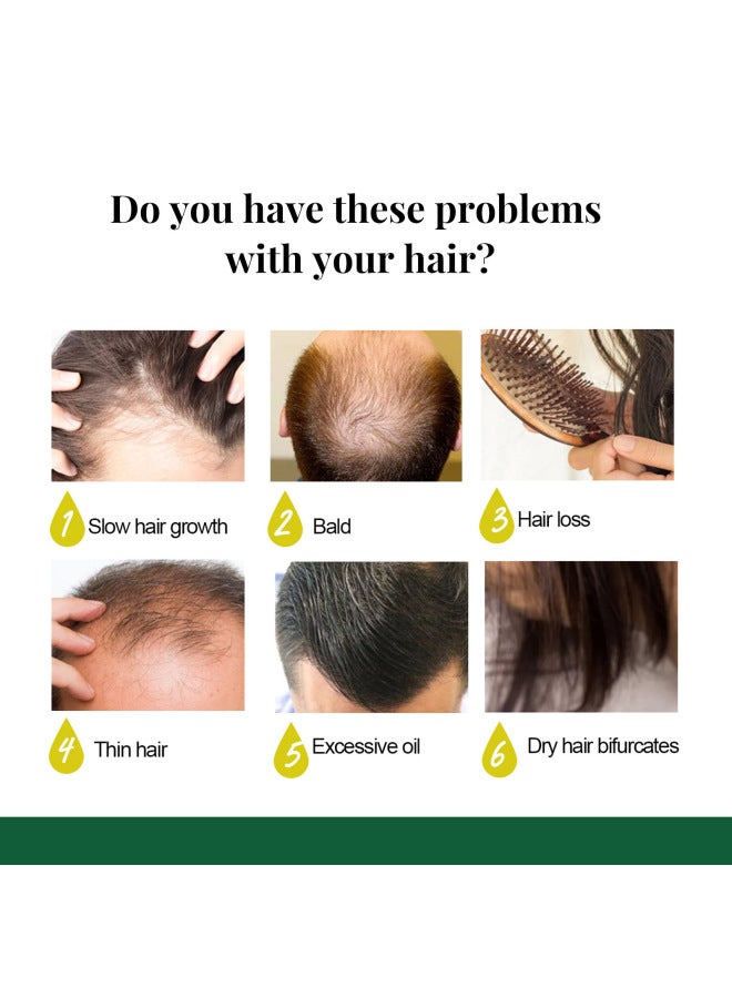 EELHOE Ginger Hair Spray Moisturizing Hair Scalp Massage Care Hair Care Solution - Image 2