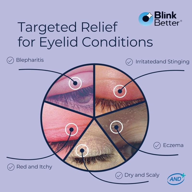 BlinkBetter BetterLids Eyelid Ointment for Dry, Itchy & Sensitive Eyelids â€“ Deep-Moisturising Oat Complex with Shea Butter & Panthenol to Hydrate, Nourish & Soothe Delicate Eyelid Skin â€“ 0.34 oz - Image 3