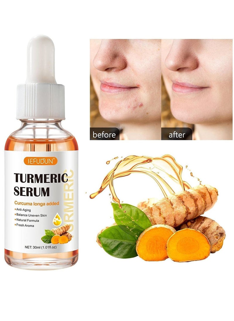 Sefudun - Turmeric Dark Spot Corrector Serum Anti Aging Face Repair Serum Natural Turmeric Bright Skin Dark Spot Skin Care Moisturizing Repair Serum Turmeric Oil for Face for Men & Women 30ml - Image 1