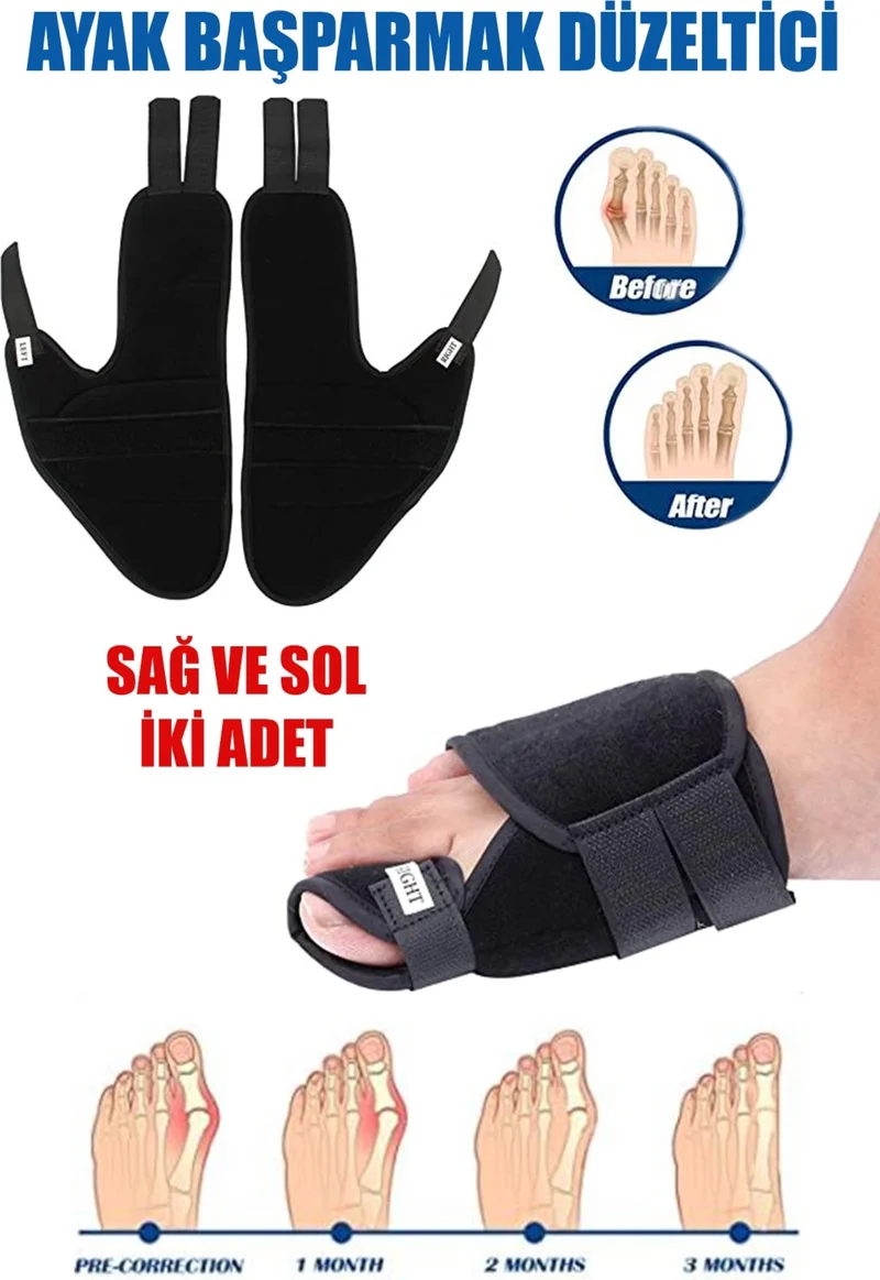 Minufco Big Toe Bone Protrusion Bunion Corrector Hallux Vallgus Foot Health Splint 1 Pair
