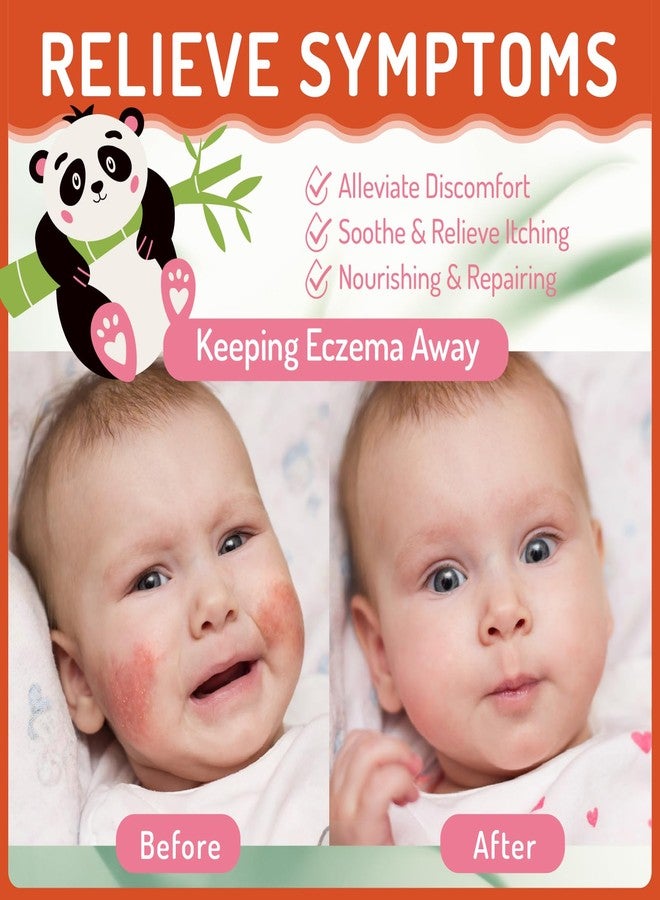 AOAO Baby Eczema Cream for Kids, Eczema Therapy & Relief Body Lotion - Nourishing Skin Protectant, Soothes Dry Irritated Skin, Hypoallergenic & Steroid-Free, 100ml/3.38oz - Image 4