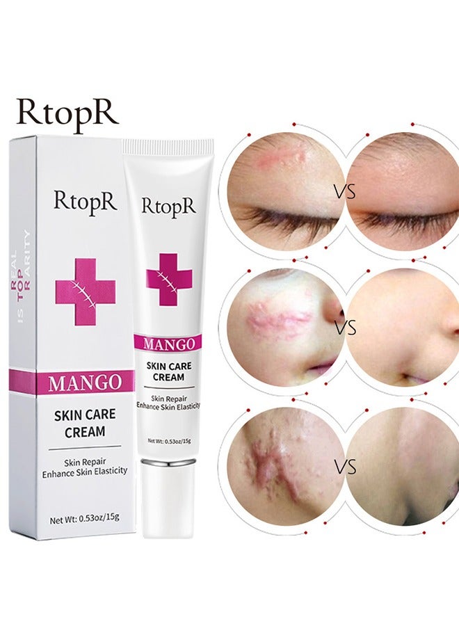 آر توب آر كريم مانجو للعناية بالبشرة ، إزالة الندبات ، إصلاح الندبات ، إصلاح البشرة ، علاج علامات التمدد ، حب الشباب ، العناية الجراحية 15 جرام - Image 1
