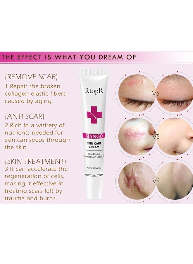 آر توب آر كريم مانجو للعناية بالبشرة ، إزالة الندبات ، إصلاح الندبات ، إصلاح البشرة ، علاج علامات التمدد ، حب الشباب ، العناية الجراحية 15 جرام - Image 3