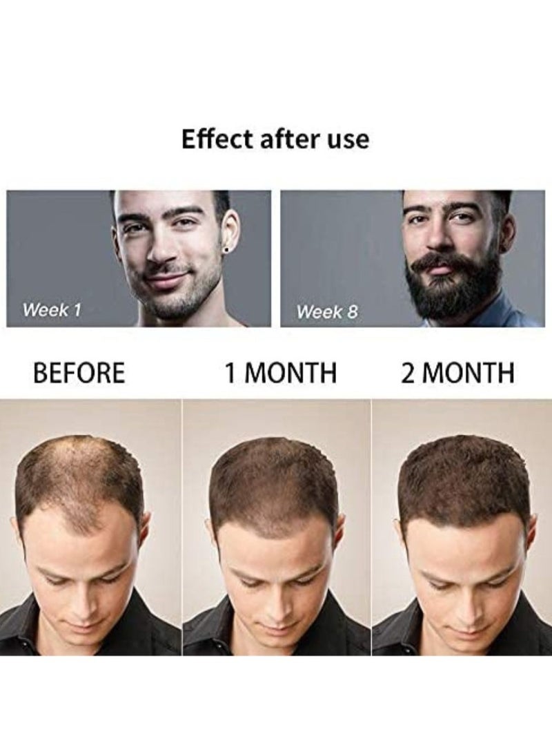 Prime Beard Face Roller 0.5 mm And 1 mm Titanium Needle skin Roller For Wrinkles anti aging Light Scarring Hyperpigmentation skin care hair care Unisex - Image 2