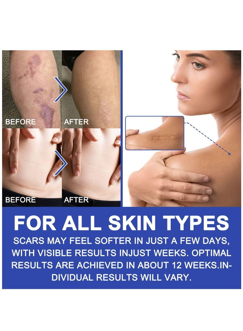 Elaimei شرائح سيليكون لإزالة الندبات (4 سم × 3 م)، شريط سيليكون جل شفاف، شرائط سيليكون طبية غير مرئية، لاصقات متقدمة شفافة لإزالة الندبات للولادة القيصرية، الكيلويد، الحروق، حب الشباب - Image 4