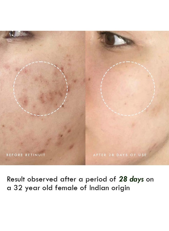 AULI LIFESTYLE Auli Retinuit 0.3% Retinol Face Oil For Anti - Ageing, Reduce Fine Lines & Wrinkles, For Women, All Skin Type - 30Ml - Image 4