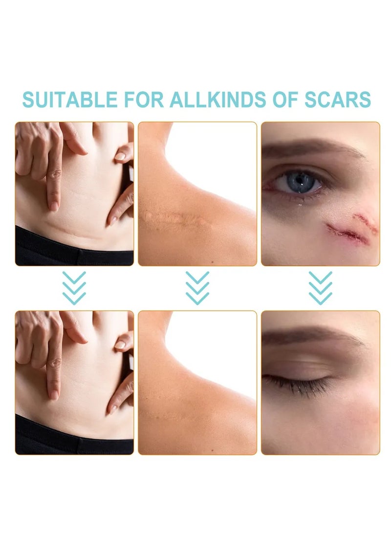 VOGSIG Medical Grade Silicone Scar Sheets Roll 3.8m Tape Keloid C-Section Surgical Scars Removal Treatment Silicon Gel Cream Patch Bandage Removes Abs Tuck Surgery Scars (4cm x 3.8m) - Image 4