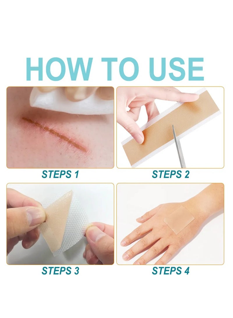 VOGSIG Medical Grade Silicone Scar Sheets Roll 3.8m Tape Keloid C-Section Surgical Scars Removal Treatment Silicon Gel Cream Patch Bandage Removes Abs Tuck Surgery Scars (4cm x 3.8m) - Image 5