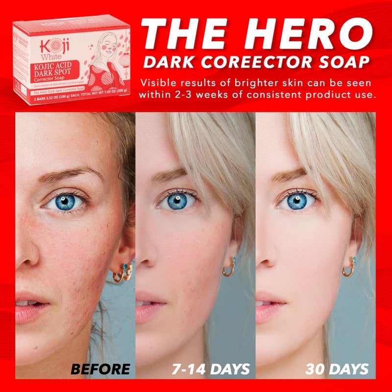 Koji White 4% Kojic Acid Dark Spot Corrector Soap For Exfoliating & Moisturizes with Vitamin C, Licorice Root Extract, Hydrating & Even Skin Tone Cleansing Bar for Face & Body, Vegan, 3.52 Oz (2 Bars) - Image 2