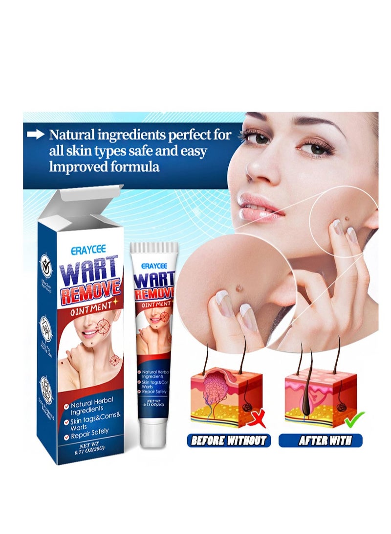 ERAYCEE 2 Pieces Wart Remove Ointment，Natural Herbal Wart Removal Cream, Treatment Of Common Warts  - Image 4