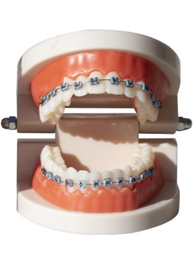 Generic Metal Braces for Orthodontics, Metal Bracket and Orthodontic Ligature Ties, Props for Dental Students to Practice - Blue  - Image 4