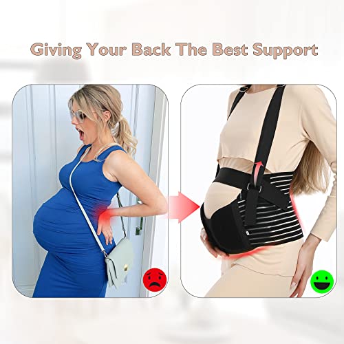Evolway Maternity Belt for Pregnancy Support and Postpartum Pelvic Recovery - Breathable Abdominal Binder with Detachable Shoulder Strap, Adjustable Sizes and Machine Washable (Black, XL) - Image 2