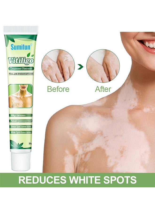 Sumifun Vitiligo Treatment Ointment, Reduces White Spots On Skin, Pigmentation Regulating, Improve Skin Pigmentation, Reduces White Spots On Skin And Vitiligo Care Cream For Skin Cares, 20G  - Image 2