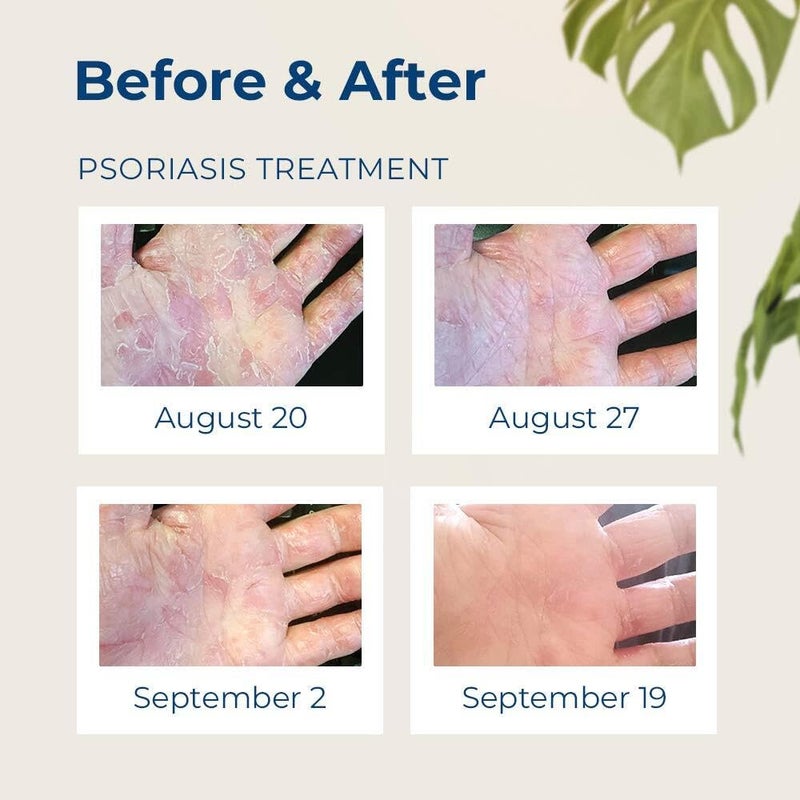 Gloves In A Bottle Shielding Lotion 3.4oz/100ml Tube + 2oz Combo - Second Skin for Hands & Body - Image 3