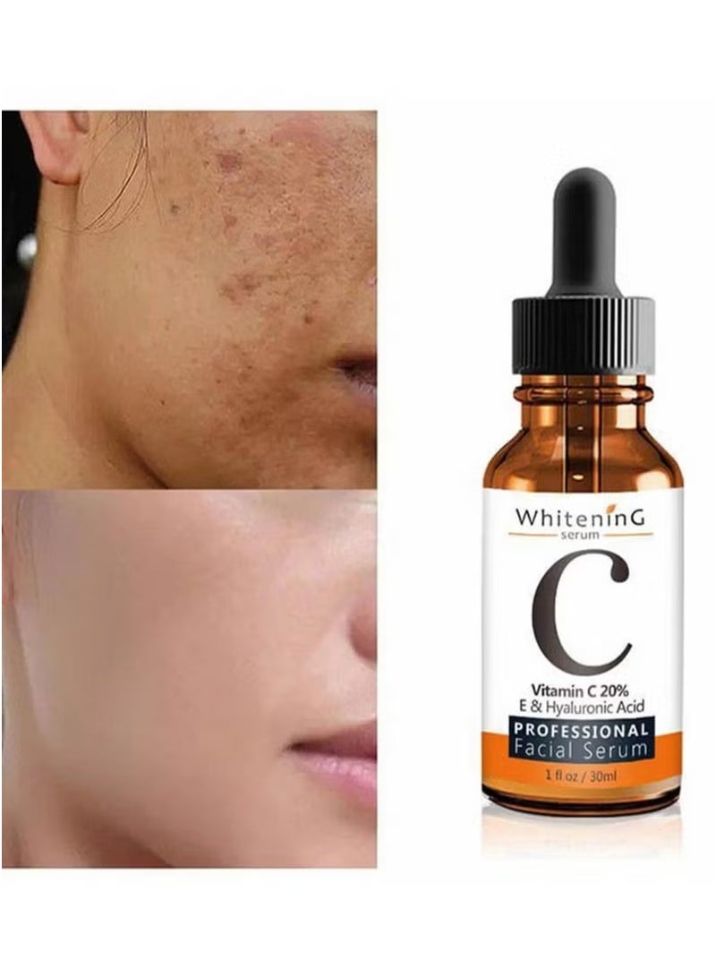 MOOYAM Vitamin C Face Serum - Anti-Aging Whitening Serum, Dark Spot Corrector, Fine Lines and Wrinkles - Image 1
