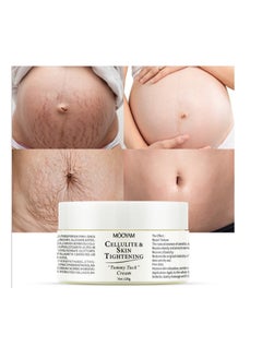 MOOYAM Stretch Mark Cream For Women (120Gm Pack Of 1) Scar Removal And Moisturizing Cream Stretch Mark Removal For Stomach Thighs And All Body Parts  - Image 1
