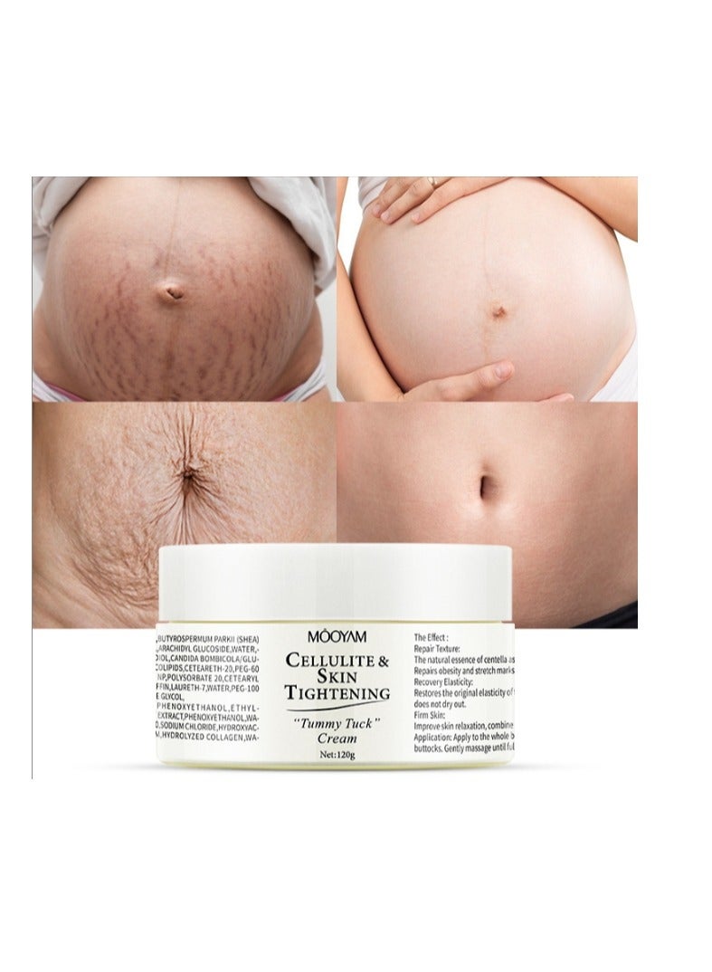 MOOYAM Stretch Mark Cream For Women (120Gm Pack Of 1) Scar Removal And Moisturizing Cream Stretch Mark Removal For Stomach Thighs And All Body Parts - Image 1
