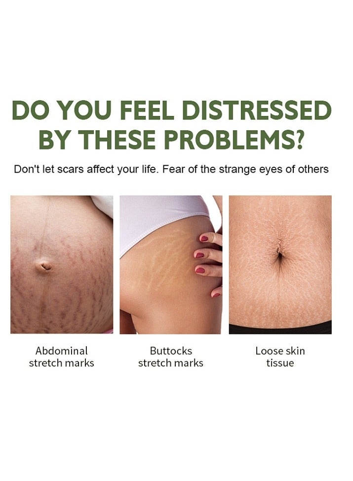 MOOYAM Stretch Mark Cream For Women (120Gm Pack Of 1) Scar Removal And Moisturizing Cream Stretch Mark Removal For Stomach Thighs And All Body Parts - Image 2