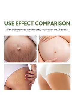 MOOYAM Stretch Mark Cream For Women (120Gm Pack Of 1) Scar Removal And Moisturizing Cream Stretch Mark Removal For Stomach Thighs And All Body Parts  - Image 3