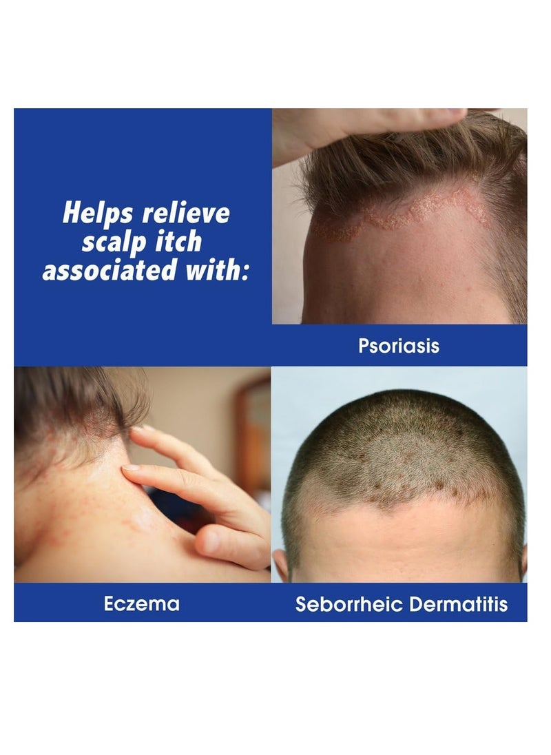 Scalpicin - Scalpicin Max Strength Scalp Itch Treatment, 1.5 oz. - Image 1