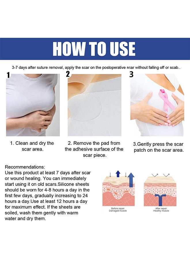 EELHOE 4 Pairs Silicone Scar Sheets, Reusable Washable Silicone Scar Tape, Surgery Scars Removal Treatment, Medical Grade Silicone Scar Sheets for Breast - Image 4
