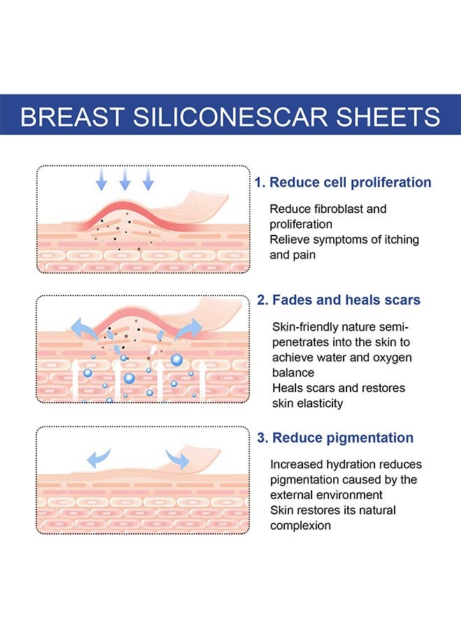 EELHOE 4 Pairs Silicone Scar Sheets, Reusable Washable Silicone Scar Tape, Surgery Scars Removal Treatment, Medical Grade Silicone Scar Sheets for Breast - Image 5