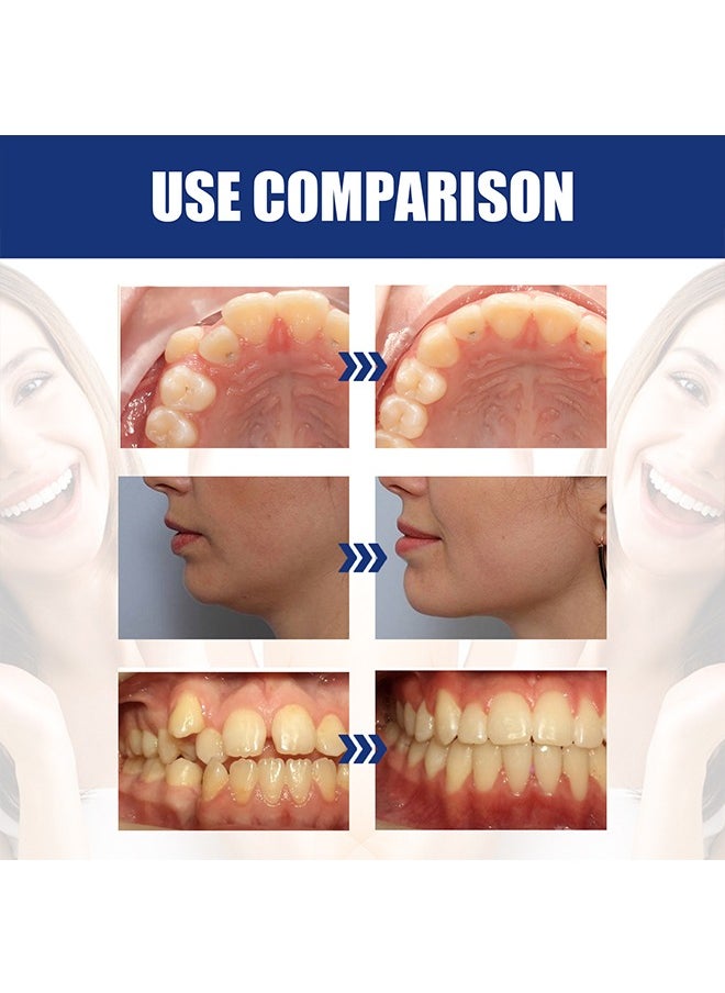 EELHOE - Jaw Adjustment Bracket - Teeth Aligners for Straightening Teeth - Correcting Chin Retraction - Crooked Teeth - Malformed Buck Teeth - Oral Care Brace - Bruxism Night Guard - Image 1