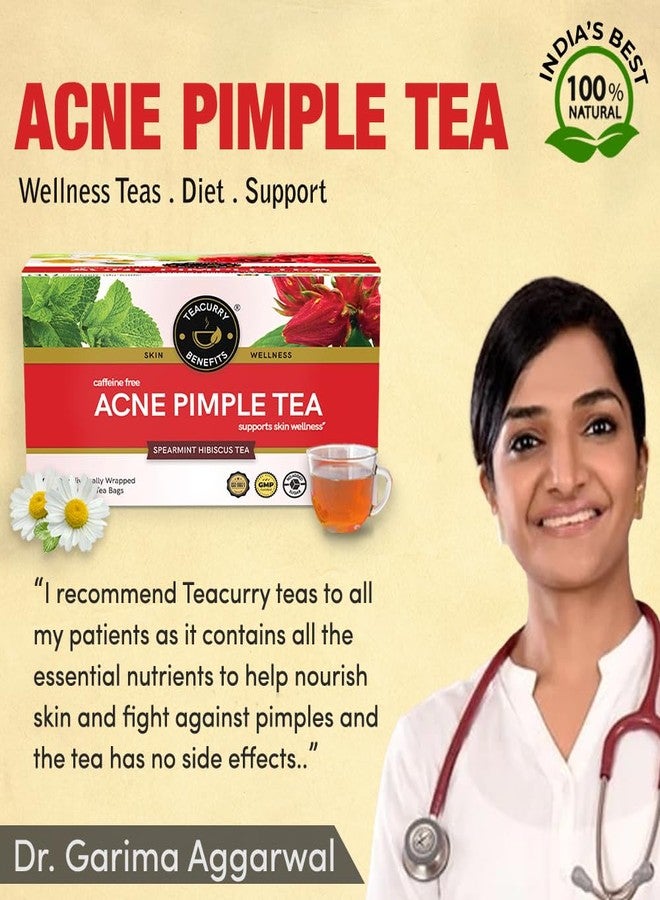 TEACURRY Tecurry Acne Pimple Tea (1 Month pack, 30 Tea Bags) - Helps with Skin Nnourishment, Reducing Pimples & Fighting pigmentation | Acne Tea - Green Tea Pimple Remover - Image 1