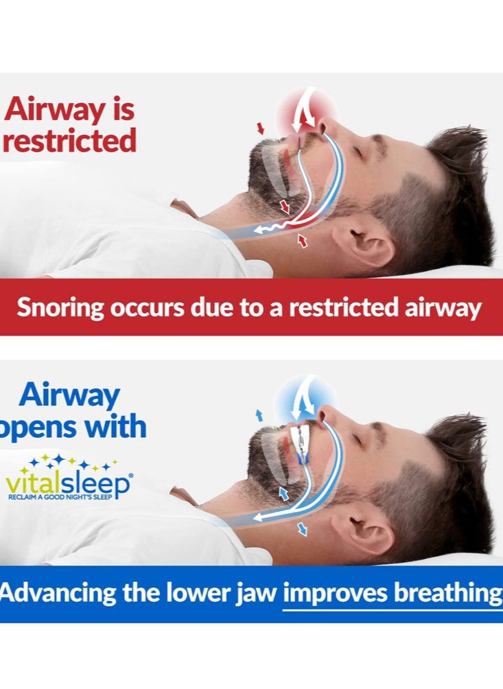 Anti-Snoring Mouthpiece Adjustable Jaw Positioning Mouth Guard