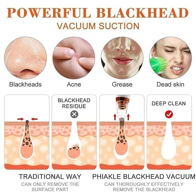 GABANIZ GABANIZ 6 in 1 Multifunction Blackhead Remover Tools  Electric Derma suction Machine  USB Rechargeable Acne Pimple Pore Cleaner Vacuum tool  Facial Cleanser Device for Nose  Skin Care  - Image 2