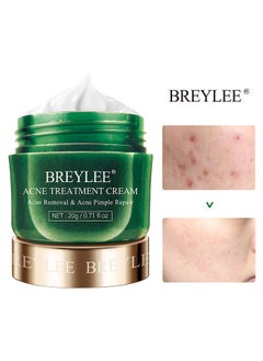 Breylee Acne Treatment Acne Removal Acne Pimple Repair Cream-Pure Skin Acne Treatment Scar Removal Cream,Natural Cystic Acne Treatment, For All Skin Types, Premium Acne Scar Cream & Pimple Remover - 20g  - Image 1