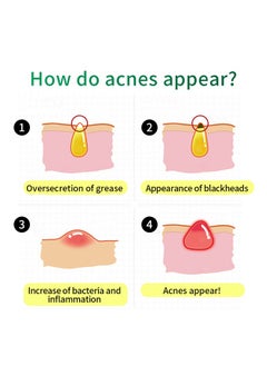 Breylee Acne Treatment Acne Removal Acne Pimple Repair Cream-Pure Skin Acne Treatment Scar Removal Cream,Natural Cystic Acne Treatment, For All Skin Types, Premium Acne Scar Cream & Pimple Remover - 20g  - Image 3