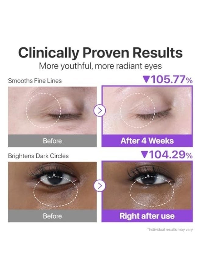 Numbuzin No.9 Eye Cream | NAD+ Retinol Volume Eye Cream | Firming, Wrinkles, Fine Lines, Dark Circles, Puffy | Retinol, Peptides, Niacinamide | Undereye Treatment Serum | 0.33 fl. oz. - Image 3