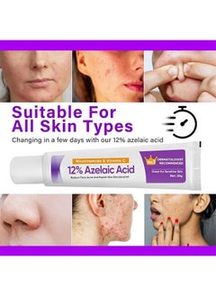 CARVENCHY 12% Azelaic Acid Cream，Hyaluronic Acid and Niacinamide, Relieves Redness, Dark Spots, Rosacea, Balances Excess Sebum, Brightening Face Skin Care Treatment for All Skin Types 20g  - Image 5