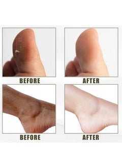 ZJchao Yellow Peeling Oil Exfoliating Skin Whitening Softening Callus Removal Dark Skin Peeling Oil For Cutin Callus Skin  - Image 5