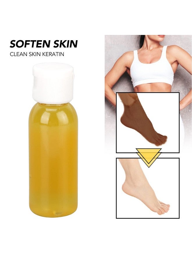 ZJchao Yellow Peeling Oil Exfoliating Skin Whitening Softening Callus Removal Dark Skin Peeling Oil For Cutin Callus Skin - Image 3