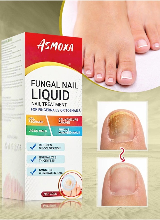 ASMOXA Fungal Nail Treatment Liquid Nail Fungus Treatment for Toenails & Fingernails Fungal Nail Renewal Anti Fungus Nail Repair Smooth & Hydrates Nail Reduce Discoloration 30ml  - Image 1