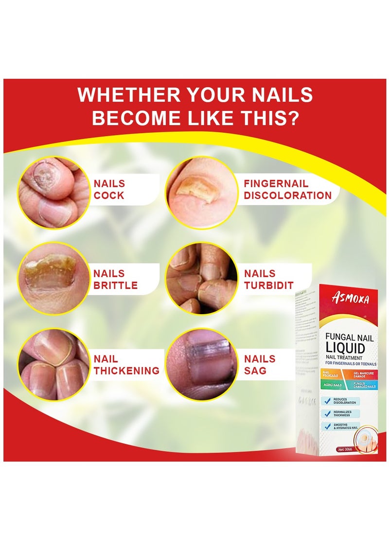ASMOXA Fungal Nail Treatment Liquid Nail Fungus Treatment for Toenails & Fingernails Fungal Nail Renewal Anti Fungus Nail Repair Smooth & Hydrates Nail Reduce Discoloration 30ml  - Image 4