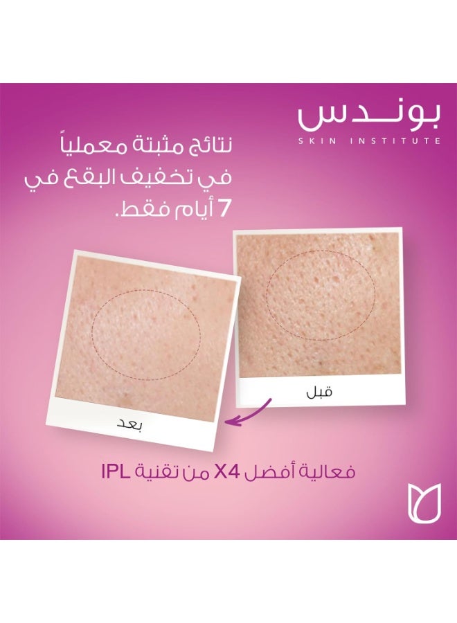 بوندز كريم ترطيب نهاري مع SPF 30 ونياسيناميد لجمال متوازن 50 مل - Image 5