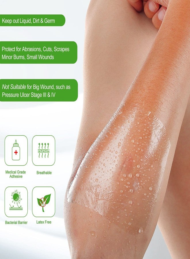 NeuHeils Transparent Film Dressing 2 3/8'' x 2 3/4'', 100 Pack, Waterproof Wound Cover Bandage, Clear IV Catheter Tape, Adhesive Patch, Shower Shield - Image 3