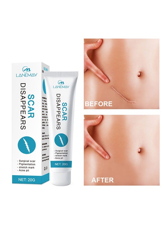 لينماي يختفي الندبة ، كريم ندبة السيليكون الطبي المتقدم جل إزالة الندبات للندوب الجراحية علامات التمدد إصابة حب الشباب الحروق الجدرة الندوب الضخامية القديمة والجديدة - Image 1