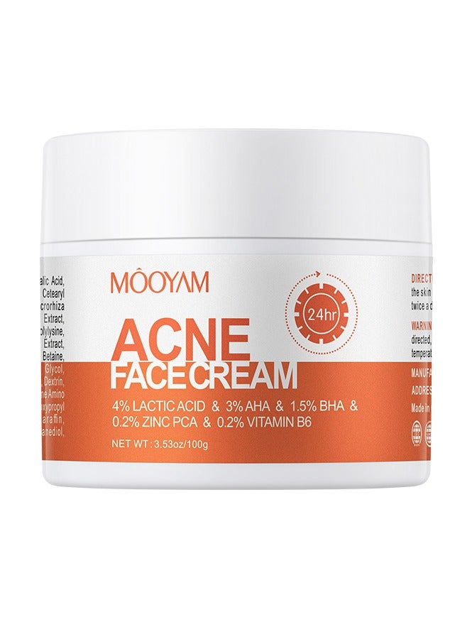 موويام كريم علاج حب الشباب للوجه لحب الشباب الهرموني الكيسي العنيد للبشرة الحساسة المراهقين البالغين 100غم - Image 2