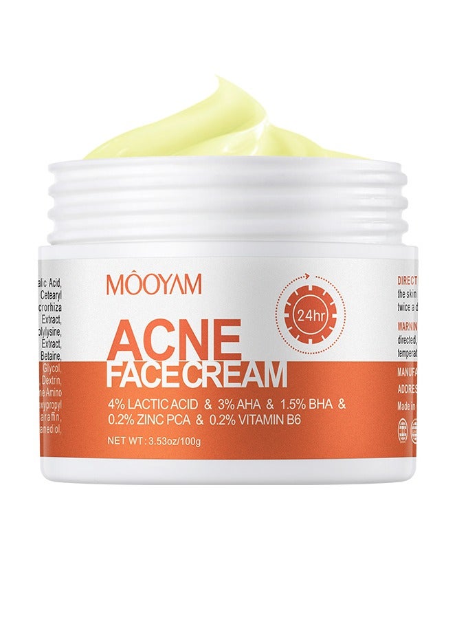 موويام كريم علاج حب الشباب للوجه لحب الشباب الهرموني الكيسي العنيد للبشرة الحساسة المراهقين البالغين 100غم - Image 1