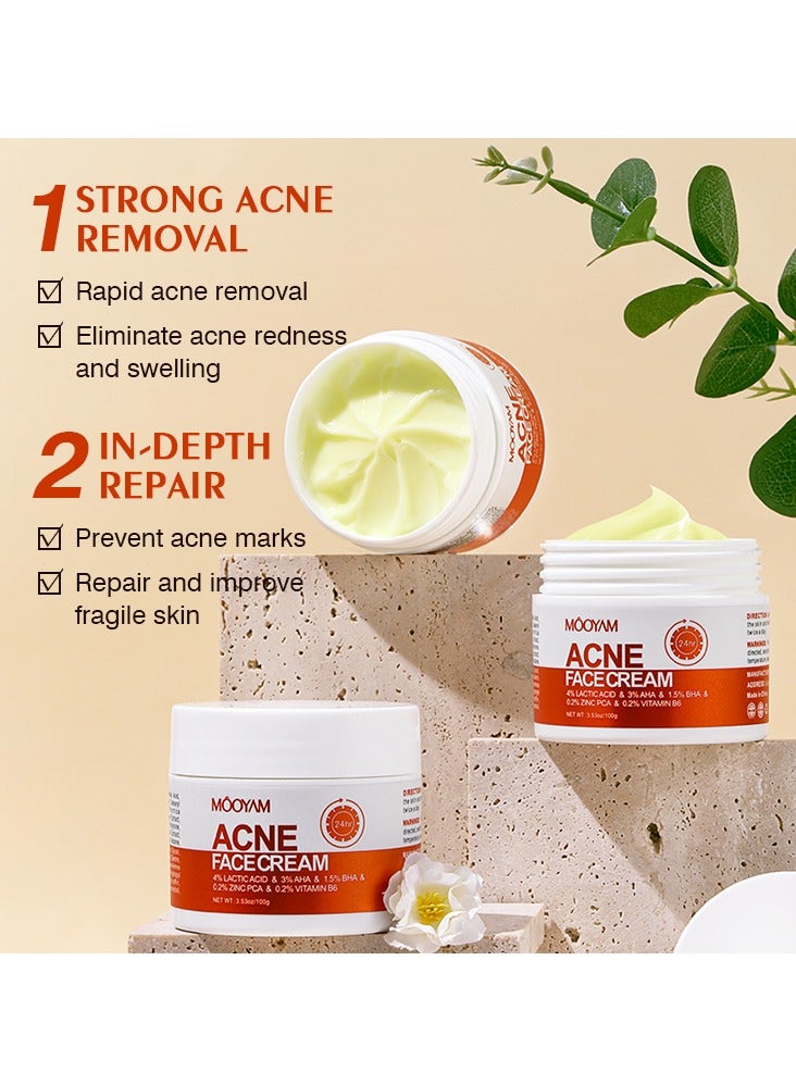 موويام كريم علاج حب الشباب للوجه لحب الشباب الهرموني الكيسي العنيد للبشرة الحساسة المراهقين البالغين 100غم - Image 3