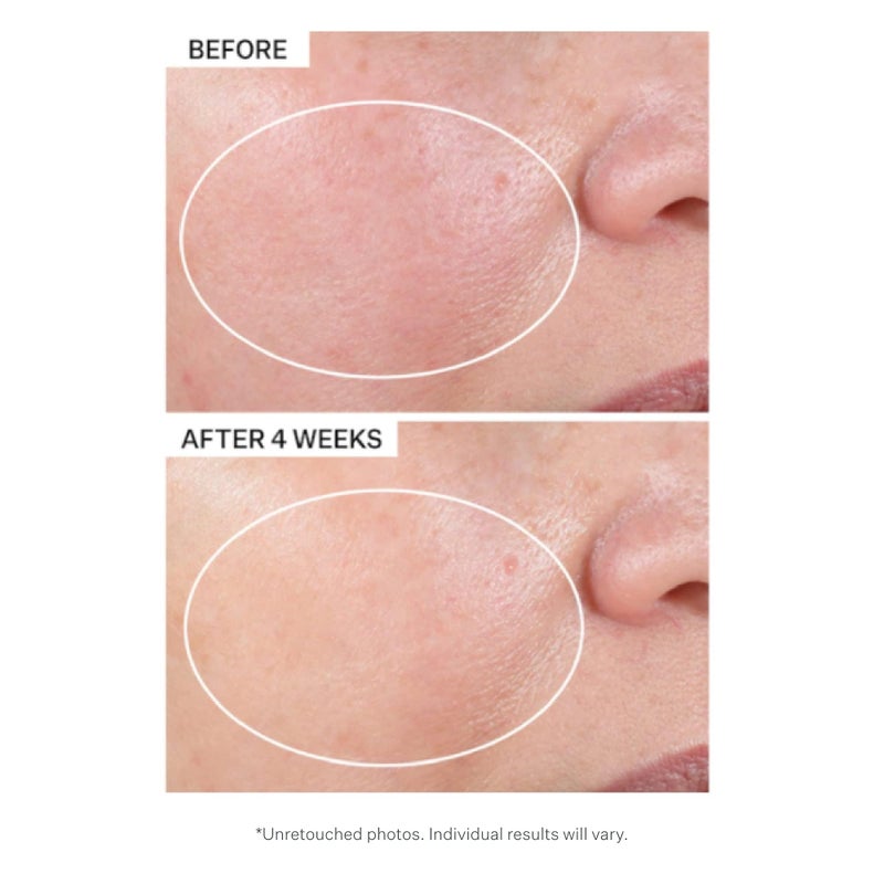 StriVectin Advanced Retinol Intensive Night Moisturizer, Targets Visible Signs of Aging for Healthier Skin, 1.7 Fl Oz - Image 4