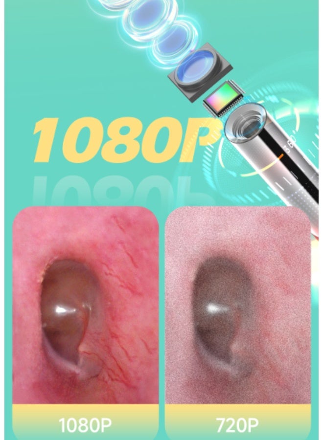 3.9mm ear endoscope camera, WiFi digital otoscope with 6 LED lights, suitable for children and pets, compatible with iOS and Android systems, comes with a carrying case (white). - Image 5